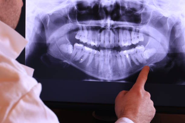 Best Emergency Dental Care for Broken or Chipped Teeth in Raymond, MS