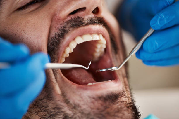 Best Cosmetic Emergency Dentistry in Raymond, MS